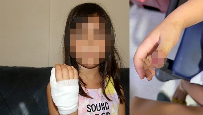 anaokulunda korkunc olay dort yasindaki cocugun parmagi koptu KmSYJF7p